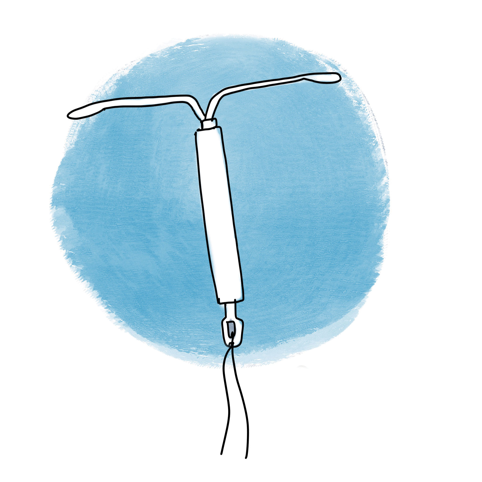 Illustration of an IUD