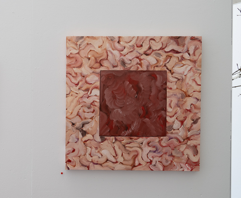 A painting shows a dark square of organ tissue circumscribed within a lighter square of a similar-looking material