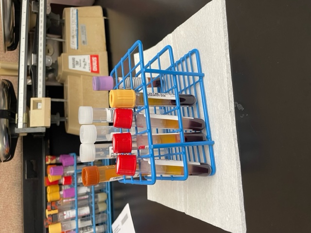 Test tubes with samples in a rack