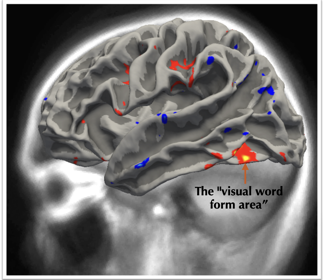 Brain Mapping Image 