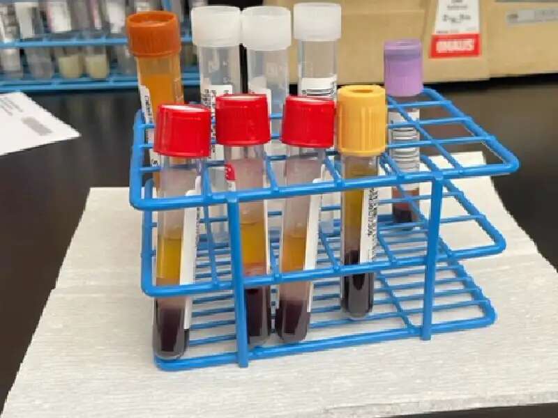Test tubes with anonymous patient samples