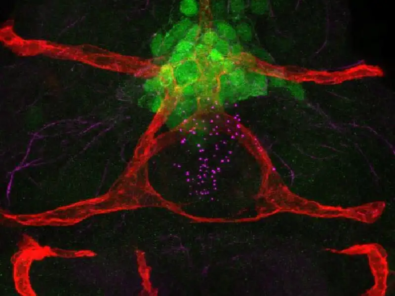 Image of Anjali Jawa's Research